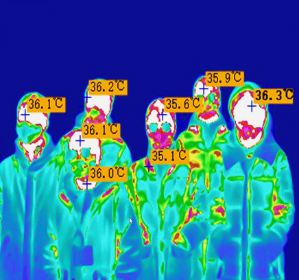 thermal camera body temperature